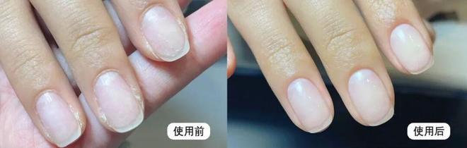 !后来发现是小丑竟然是我的手开元棋牌一直以为是首饰太丑(图3) !后来发现是小丑竟然是我的手开元棋牌一直以为是首饰太丑(图3)