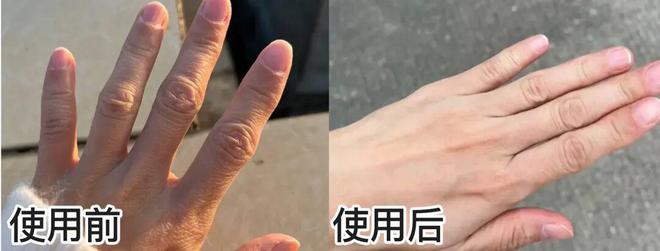 !后来发现是小丑竟然是我的手开元棋牌一直以为是首饰太丑(图2) !后来发现是小丑竟然是我的手开元棋牌一直以为是首饰太丑(图2)