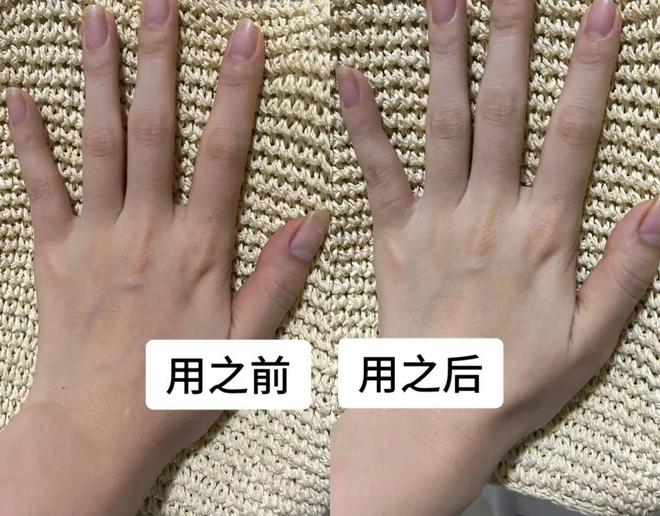 !后来发现是小丑竟然是我的手开元棋牌一直以为是首饰太丑(图18) !后来发现是小丑竟然是我的手开元棋牌一直以为是首饰太丑(图18)